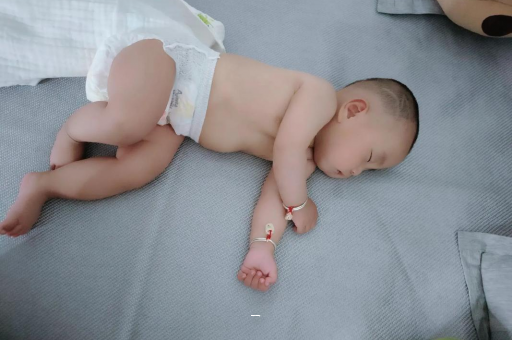 借卵生子咨询宝宝脸上有白色斑块